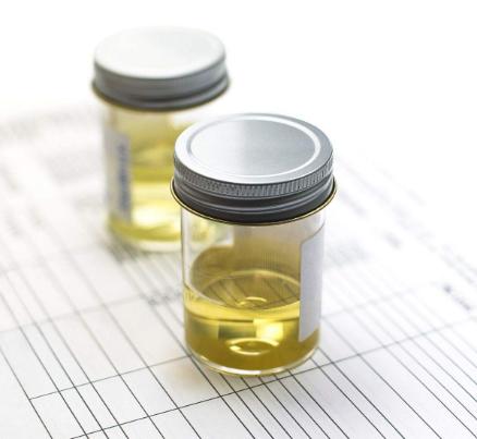 肾病尿蛋白经过药物治疗能消退吗,肾炎导致尿蛋白2+需要治疗吗