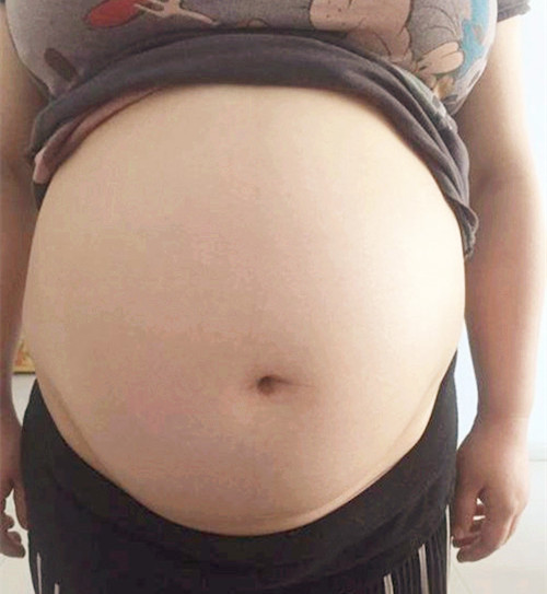 孕妇顺产被丈夫强行制止,顺产时难产把手伸肚子里