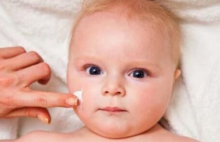 宝宝脸上高原红,冬季宝宝脸高原红用什么擦