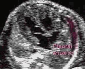 准妈妈看过来孕期瑜伽,孕期b超知识大全