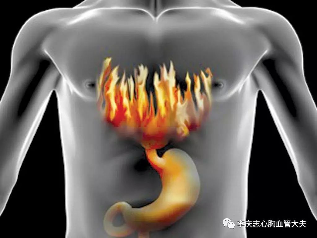 最常引起胸痛的是哪种肺癌,常见致命性胸痛有哪些