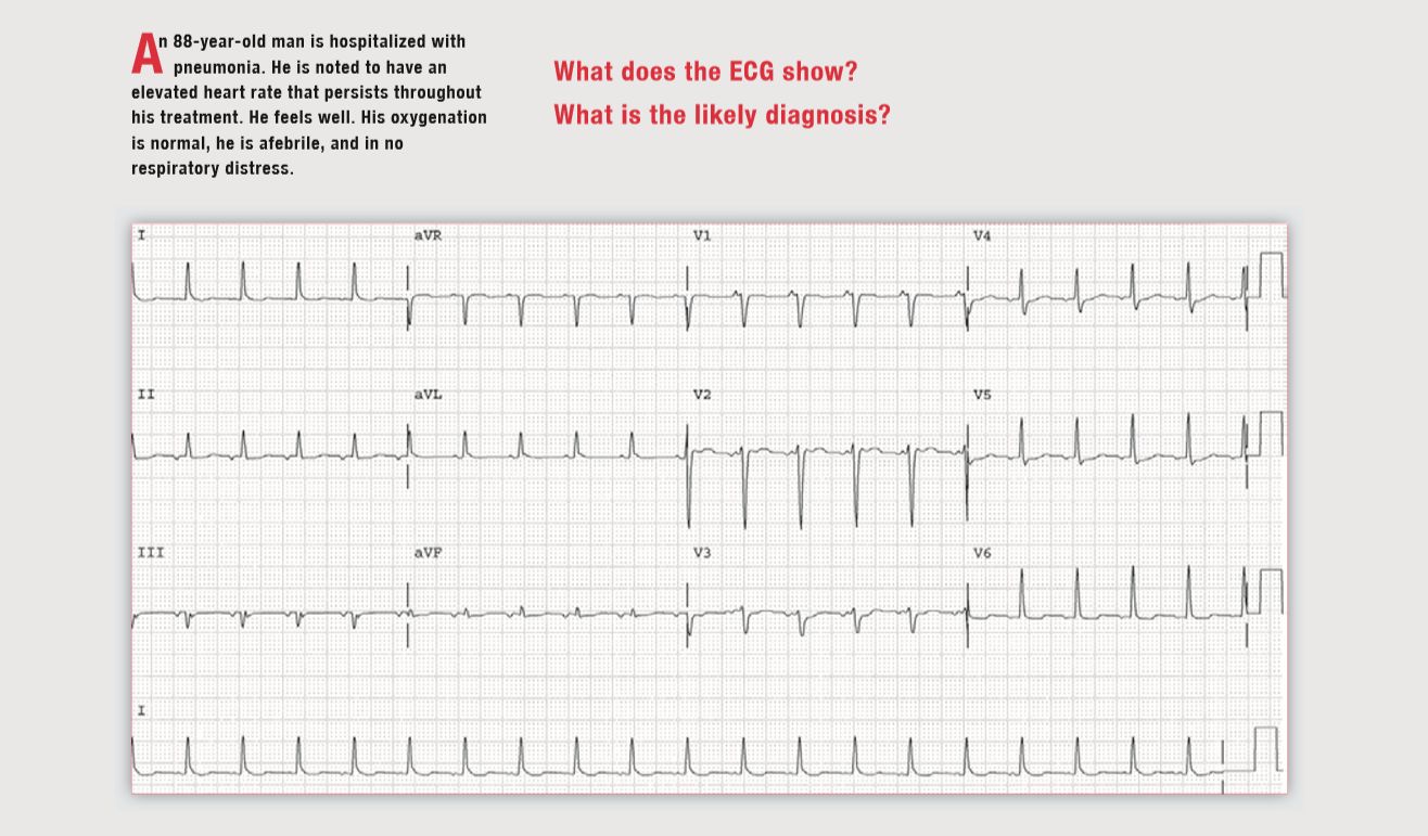读心有术30期,读心有术183