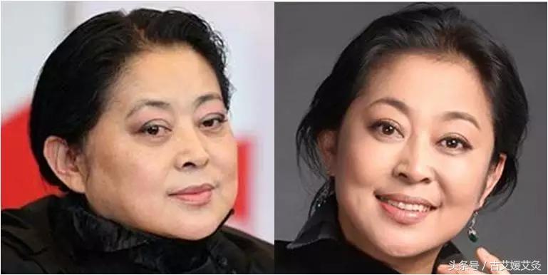 去眼袋的艾灸方法,孩子眼圈黑眼袋大怎么艾灸