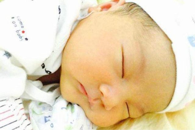 新生儿护理，宝宝身上有这些异样并非是病，爸妈们不必担心