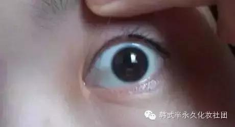 纹美瞳线七天脱痂过程图,纹美瞳线掉痂后反色过程图