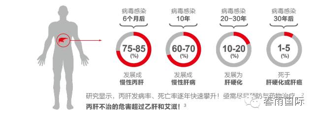 沉默的杀手丙肝,科普警惕沉默杀手丙肝