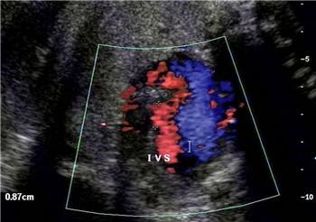 孕妇吃堕胎药却被孩子知道,孕妇喝下堕胎药肚子剧痛