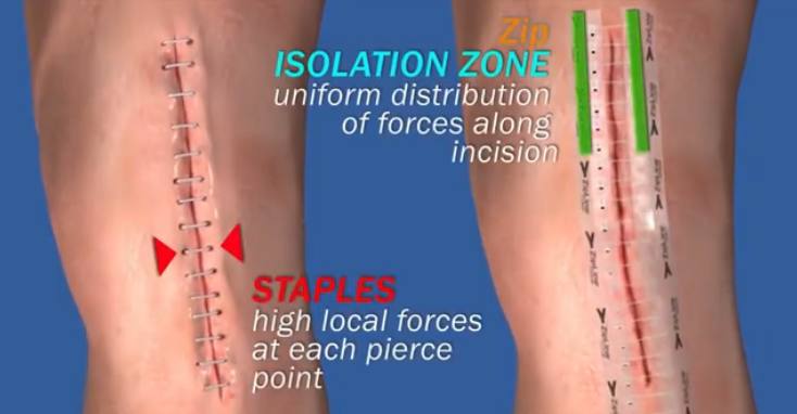 婊存按涔嬪,婊存按涔嬪鍜嬫牱