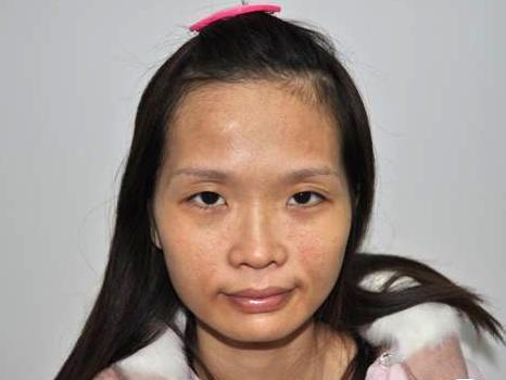 解决皮肤暗黄四点轻松搞定,皮肤暗黄肤色不均的福音