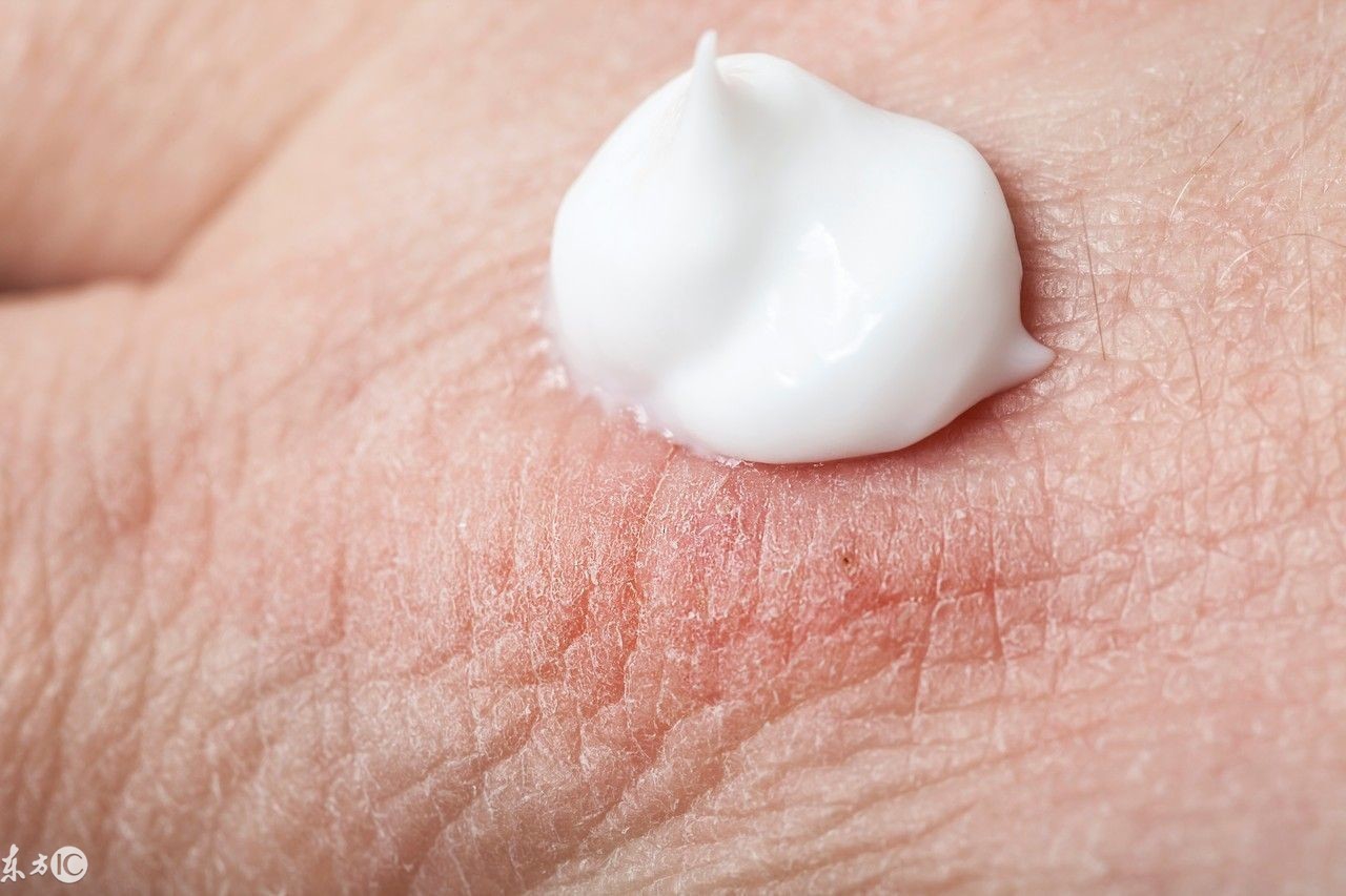 澳洲直邮绵羊油,好用澳洲绵羊油