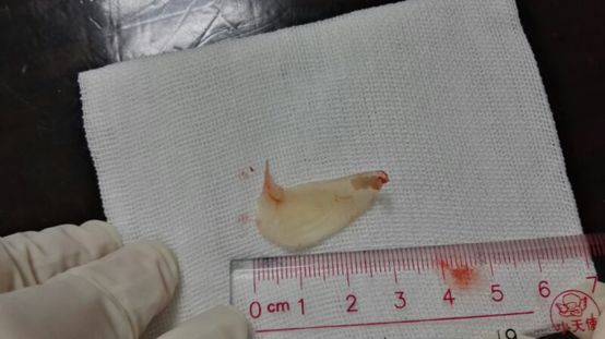 误吞一根鱼刺的危害,误吞鱼刺的解决方法