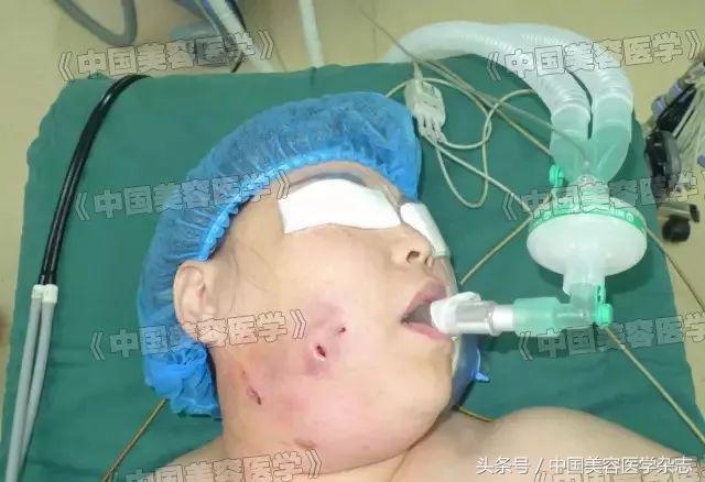 解放军医院治烫伤,解放军医院烧伤特效药