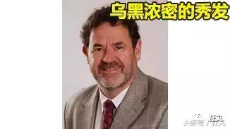 日本研究秃顶,日本教授秃头研究