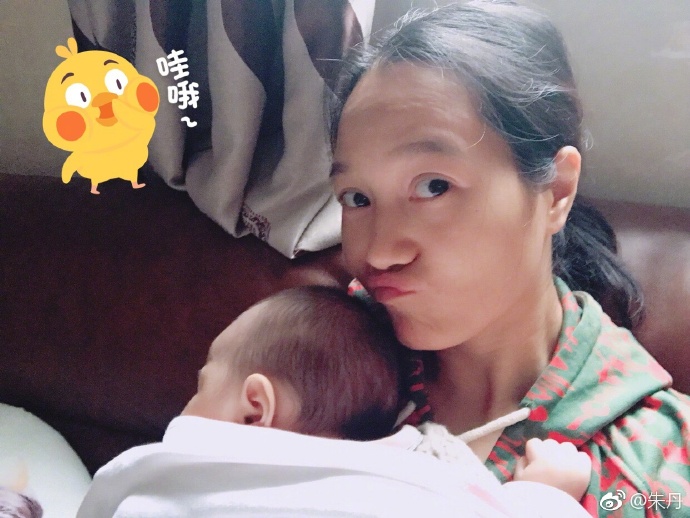 产后发际线问题有救了,产后危及发际线