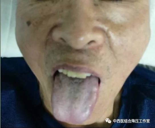 治感冒发烧用的方子用到哪味中药,治风寒感冒发烧咳嗽绝密偏方