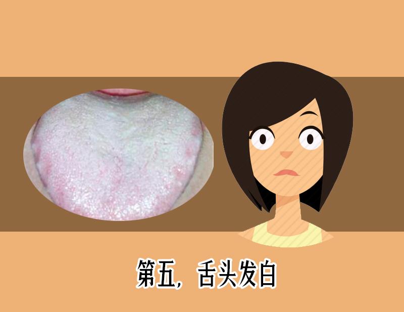 舌苔发黑辨证,舌苔发青警惕四种原因