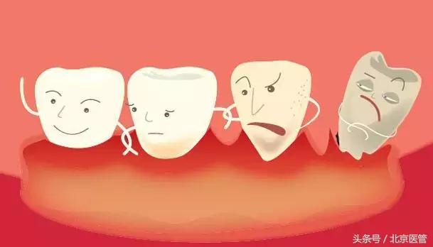 牙龈肿痛刷牙时出血啥原因,牙龈肿痛刷牙会出血吗