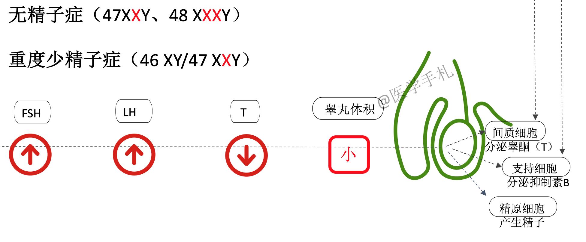 克氏综合征的人染色体会缺失吗,克氏综合征是染色体多吗
