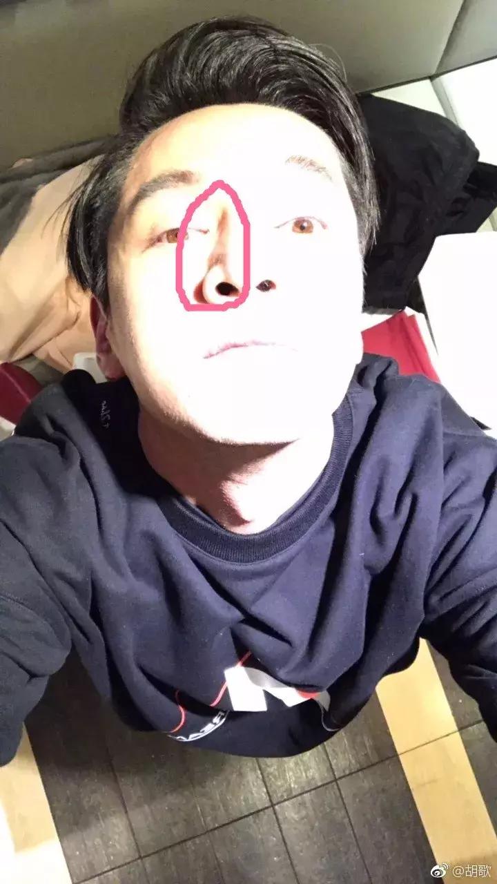 蒜头鼻变美的四个小妙招,蒜头鼻鼻头怎么塑形最好看