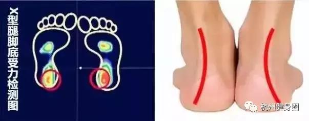 如何选适合自己的跑鞋,如何选一双适合自己的跑鞋