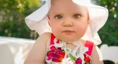 宝宝皮肤护理小知识,夏季宝宝皮肤护理