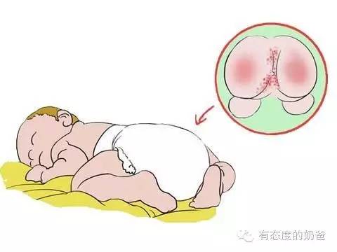 这些错误的使用方式不得不防,护臀功效和使用方法