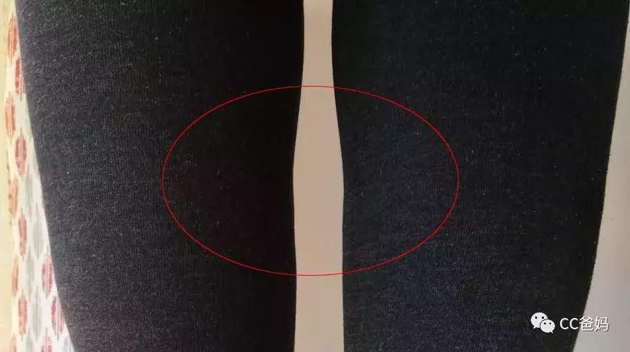 生娃后小肚子鼓鼓的是怎么回事,生娃后肚子松弛减肥会变紧致吗