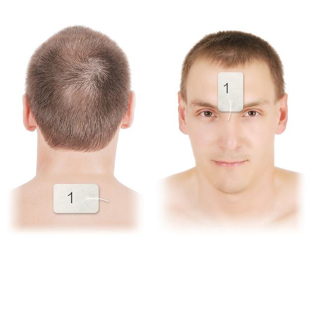 鼻炎有5大疗法,鼻炎属于什么经络出现问题