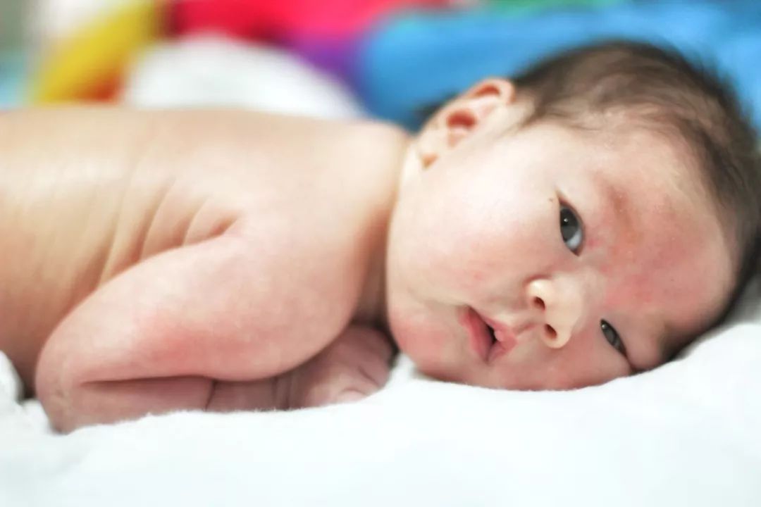 小孩出湿疹最好的解决办法,小孩湿疹最好的办法