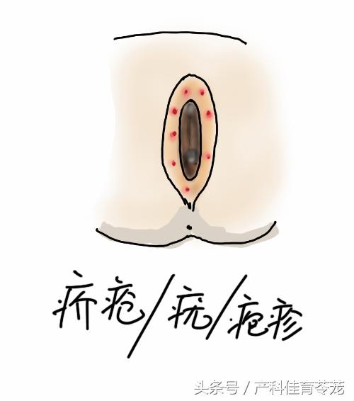 顽固性外阴瘙痒治不好了吧,不明原因的外阴瘙痒怎么办