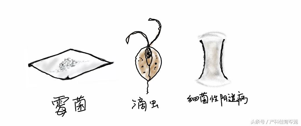 治疗妇科外阴瘙痒用什么洗最好,外阴瘙痒有破溃处擦什么药有效