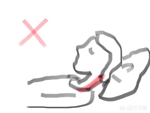 脖子后面富贵鼓包怎么改善,脖子后鼓起来是富贵包吗