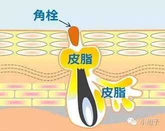 顽固草莓鼻怎么改善,消除草莓鼻的最快方法美容院