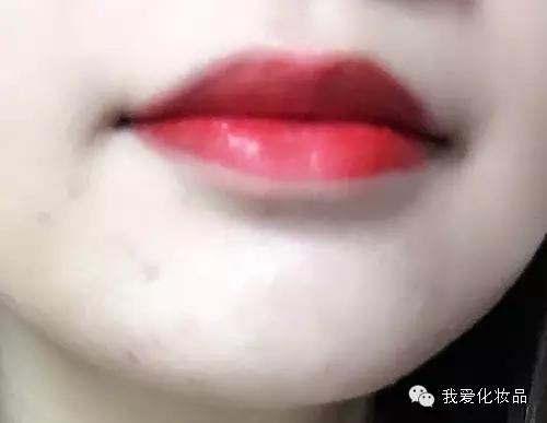 油皮痘肌适合的护肤品牌子,混油皮痘肌适用的护肤品推荐