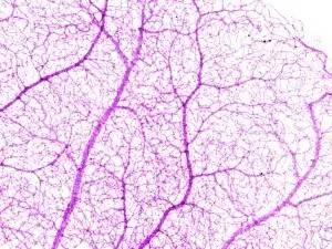 解决路痴最好的方法,路痴用什么方法解决