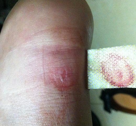 皮鞋磨脚趾头的小妙招,生活小妙招皮鞋凹陷怎么恢复