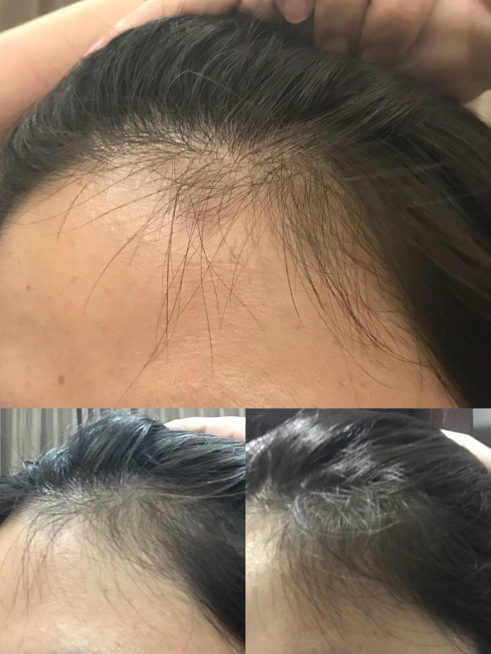 去泰国哪种面膜值得买,泰国面膜推荐泰国必买清单