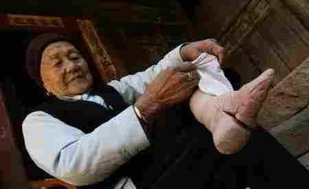 古代病态审美束腰裹脚,古代小脚畸形