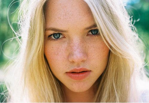 5分钟快速祛斑方法,祛斑知识