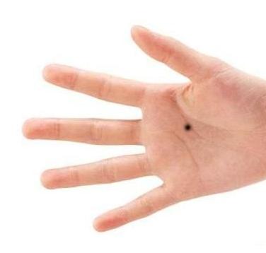 身体哪个部位有痣代表以后会富,人在哪些地方有痣会发大财