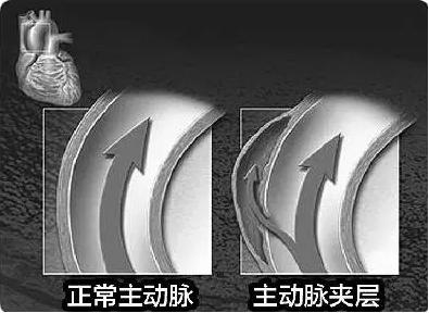 中科院与北医三院,中科院和北医三院