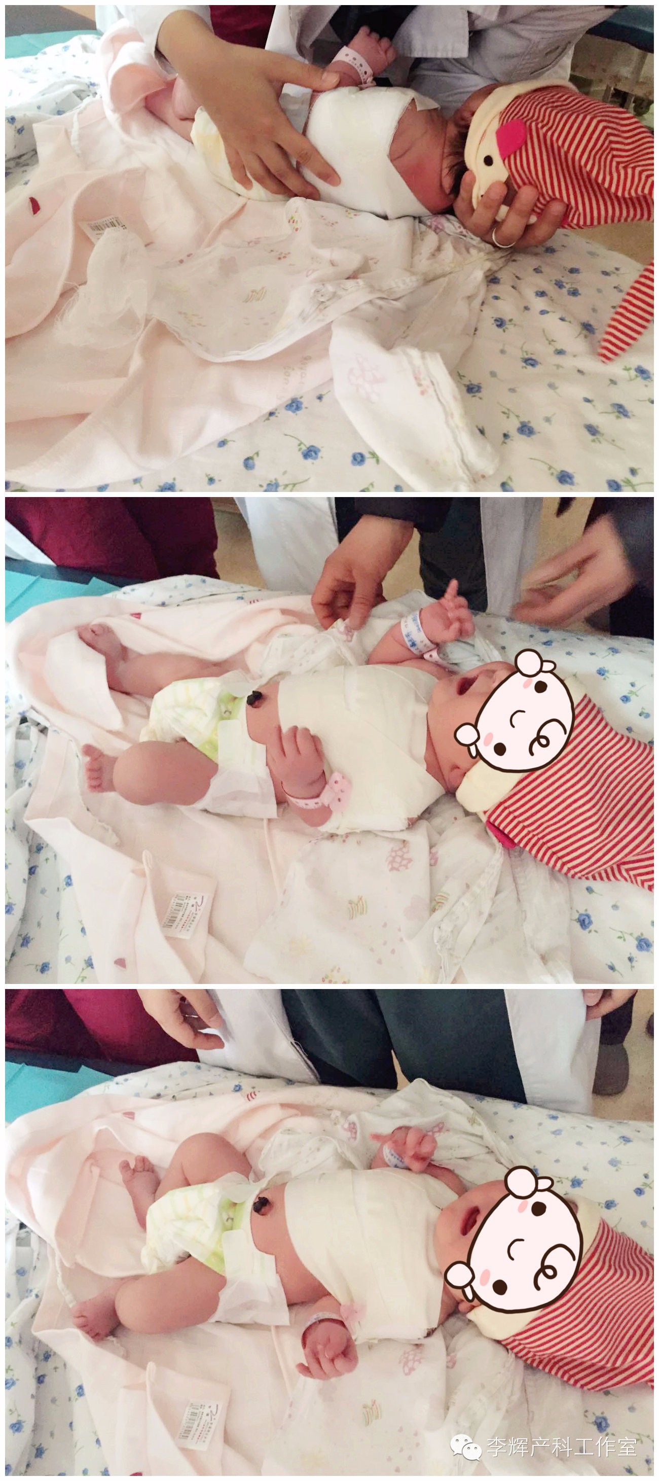 新生儿为什么会锁骨骨折,顺产宝宝锁骨骨折的原因