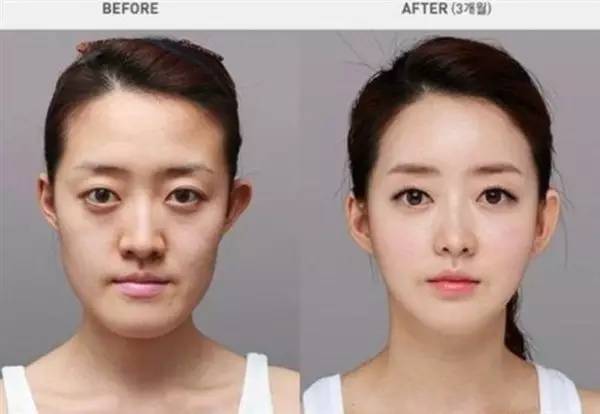 汗！温州一男子点掉了脸上的痣，结果在*证办**时“遇阻”！原因是......