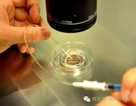 试管婴儿八个卵泡,试管婴儿身体调理书