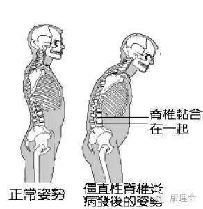 一得这病就是一辈子？！周杰伦张嘉译都中招
