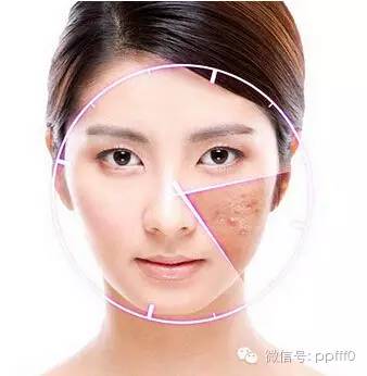 中药治疗激素依赖性皮炎,激素依赖性皮炎怎么治