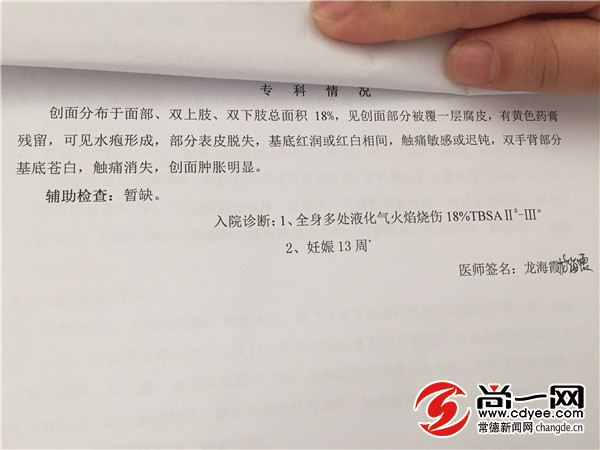 烧伤恢复期疼痛吃止痛药行吗,孕妇烧伤怎么处理