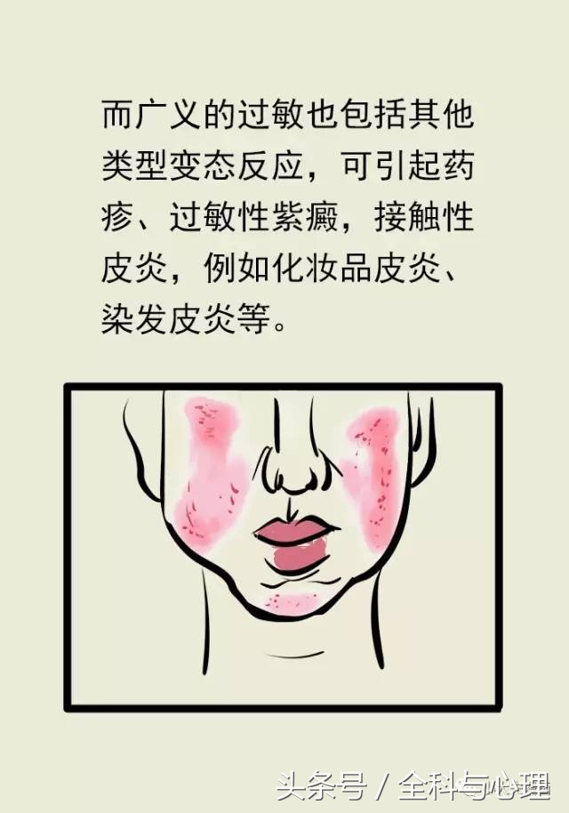 世界过敏性日知识你知道吗,世界过敏日科普视频