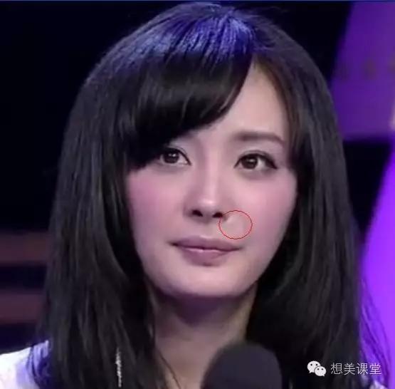 脸再美妆再浓，一颗痘痘毁你容！