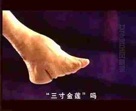 古代病态审美束腰裹脚,古代小脚畸形